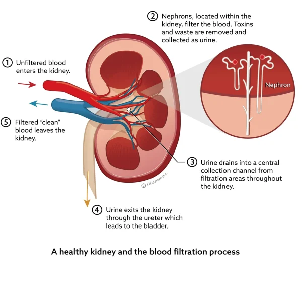 Acute Kidney Injury in Cats