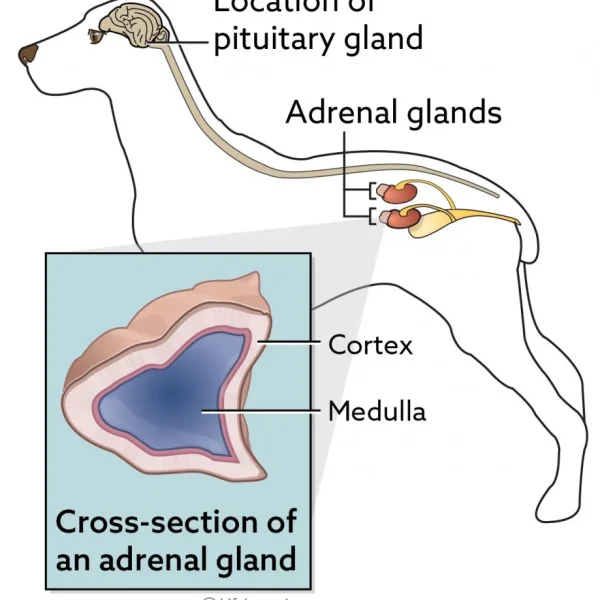 Adrenal Medulla Tumors