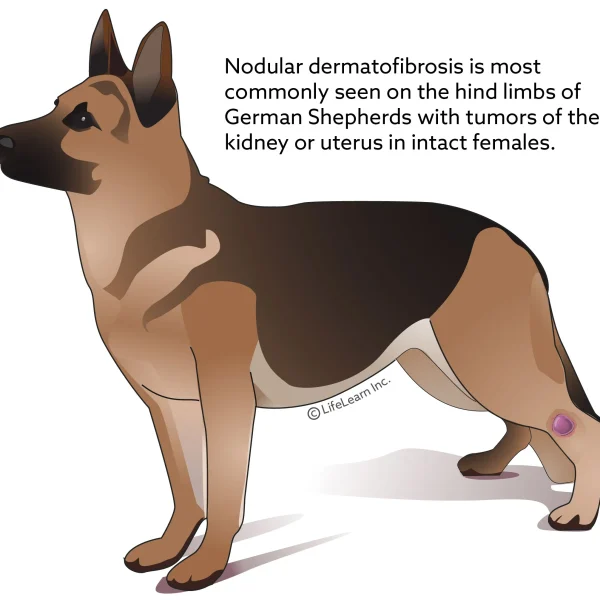 Benign Fibrous Skin Tumors