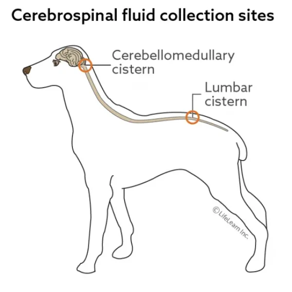 Cerebrospinal Fluid Collection and Examination