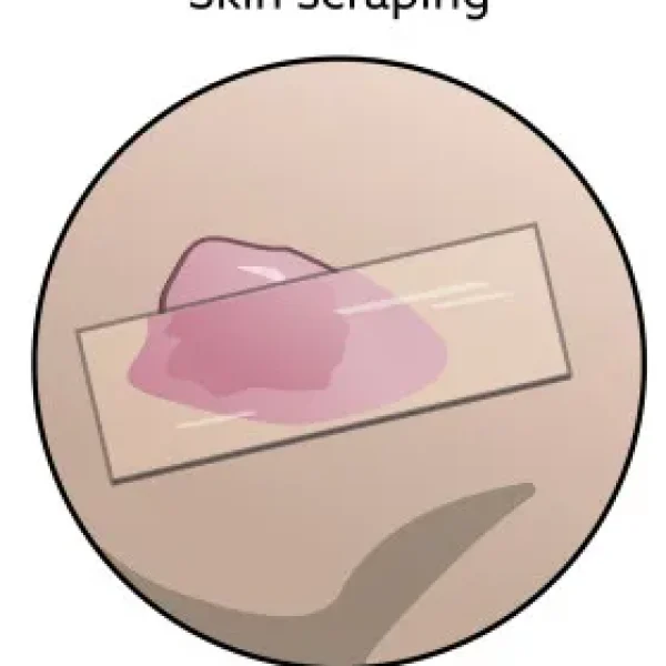 Cytology, Biopsy, and Histopathology