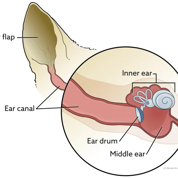 Ear Canal Tumors