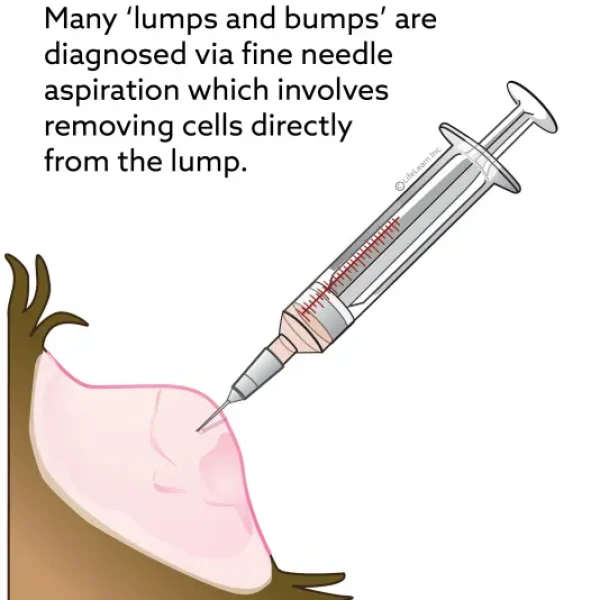 Fine Needle Aspiration (FNA)