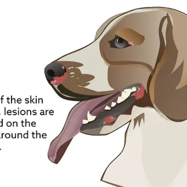 Lymphoma of the Skin