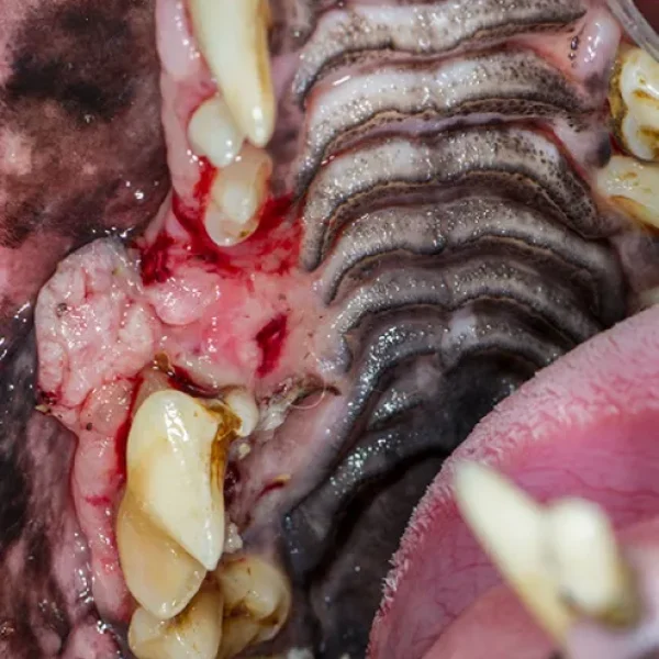 Oral Tumors - Squamous Cell Carcinoma