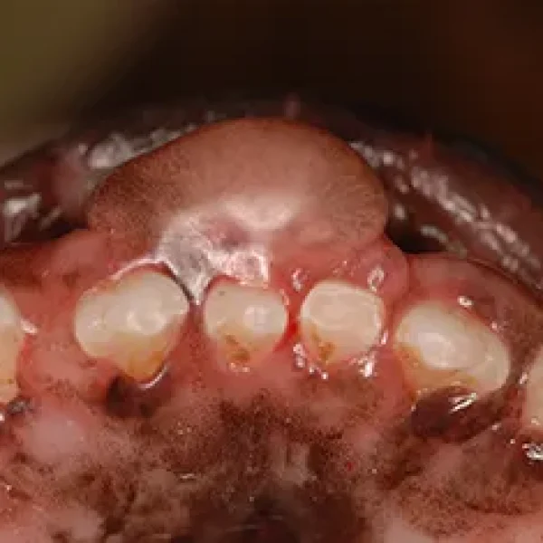 Oral Tumors in Dogs - An Overview