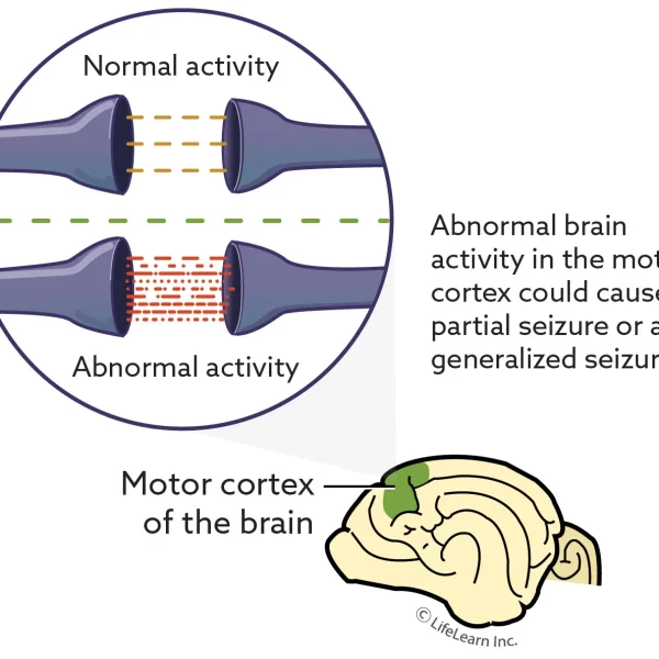 Seizures and Syncope