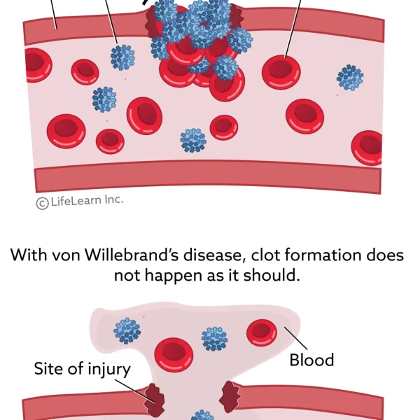 Von Willebrand's Disease Testing